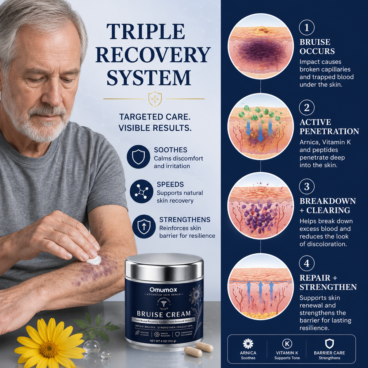 💥100K+ SOLD💕- Omumax® Bruise Repair & Skin-Strengthening Cream