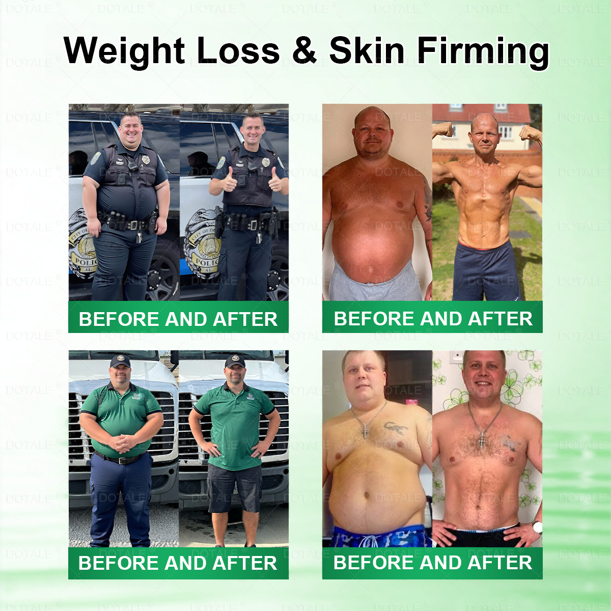 Omumax® 𝑴𝒆𝒕𝒂𝒃𝒐𝒍𝒊𝒄 𝑵𝒂𝒏𝒐 𝑴𝒊𝒄𝒓𝒐𝒏𝒆𝒆𝒅𝒍𝒆 𝑷𝒂𝒕𝒄𝒉🇺🇸(𝐉𝐮𝐬𝐭 𝐨𝐧𝐜𝐞 𝐚 𝐝𝐚𝐲, 𝐯𝐢𝐬𝐢𝐛𝐥𝐞 𝐜𝐡𝐚𝐧𝐠𝐞𝐬 𝐢𝐧 𝟕 𝐝𝐚𝐲𝐬）𝘽𝙚𝙧𝙗𝙚𝙧𝙞𝙣𝙚 + 𝙈𝙤𝙧𝙞𝙣𝙜𝙖 𝙁𝙤𝙧𝙢𝙪𝙡𝙖 ✅ 𝐅𝐨𝐫 𝐨𝐛𝐞𝐬𝐢𝐭𝐲, 𝗟𝗼𝗼𝘀𝗲 𝘀𝗸𝗶𝗻,𝐝𝐢𝐚𝐛𝐞𝐭𝐞𝐬, 𝐬𝐥𝐞𝐞𝐩 𝐚𝐩𝐧𝐞𝐚, 𝐣𝐨𝐢𝐧𝐭 𝐢𝐬𝐬𝐮𝐞𝐬, 𝐚𝐧𝐝 𝐦𝐨𝐫𝐞 💥💥